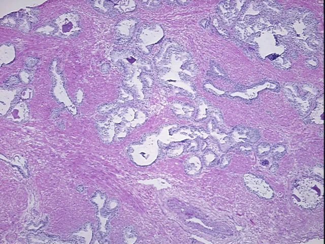 Frozen Tissue Sections, Prostate - image 1