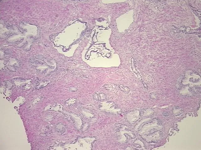 Frozen Tissue Sections, Prostate - image 1