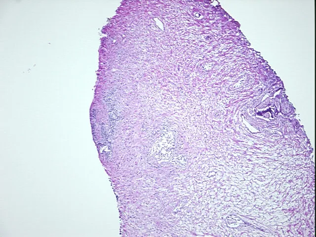 Frozen Tissue Sections, Prostate - image 1