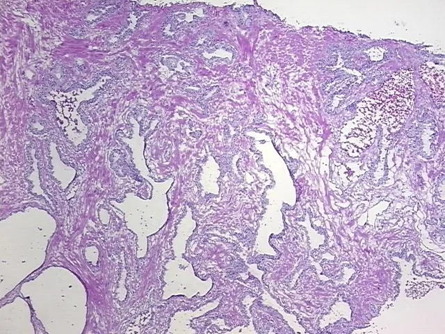 Frozen Tissue Sections, Prostate - image 1