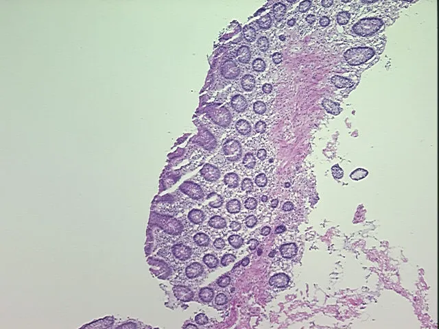 Frozen Tissue Sections, Colon - image 1