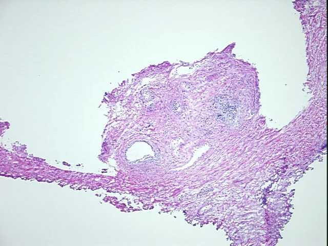 Frozen Tissue Sections, Prostate - image 1