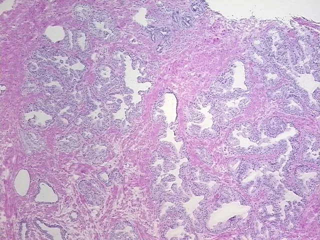 Frozen Tissue Sections, Prostate - image 1
