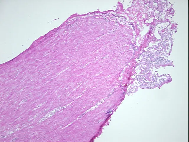 Frozen Tissue Sections, Duodenum - image 1