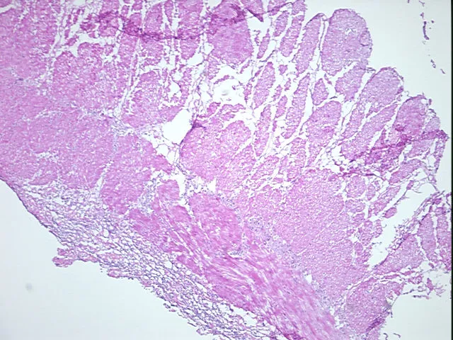 Frozen Tissue Sections, Duodenum - image 1