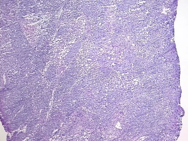 Tissue FFPE Sections, Breast - image 1