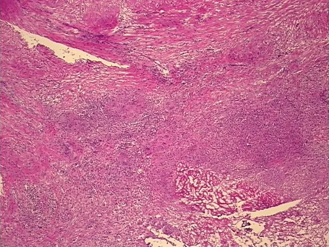 Frozen Tissue Sections, Urinary bladder - image 1
