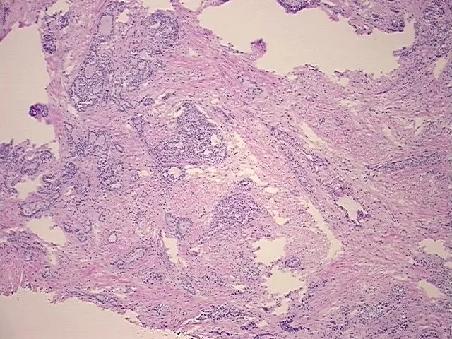 Tissue FFPE Sections, Breast - image 1