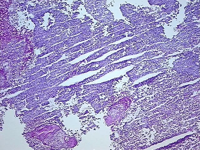 Frozen Tissue Sections, Urinary bladder - image 1