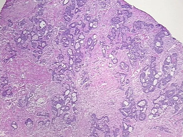 Frozen Tissue Sections, Rectum - image 1