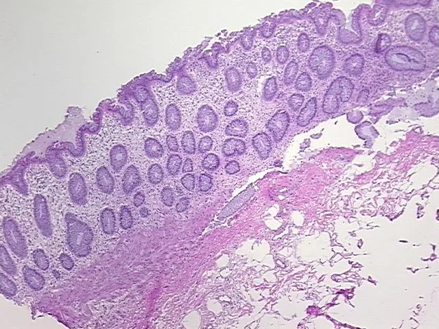 Frozen Tissue Sections, Rectum - image 1