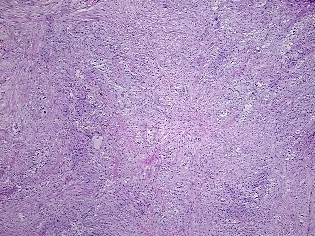 Tissue FFPE Sections, Lung - image 1