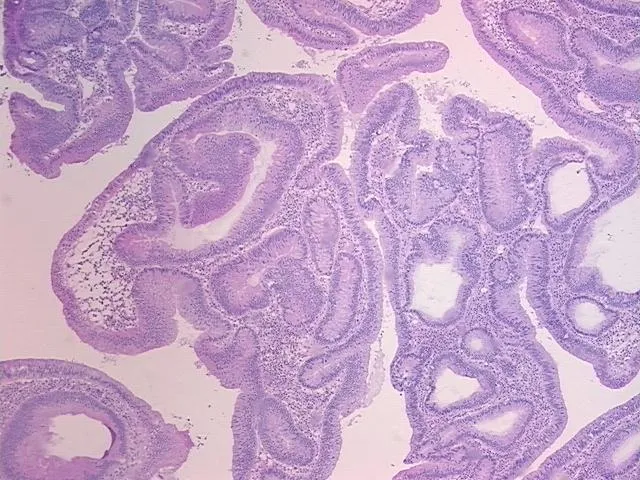 Frozen Tissue Sections, Colon - image 1