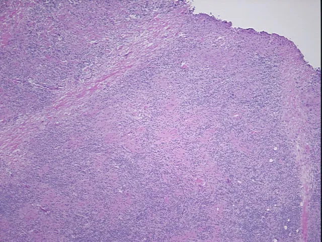 Frozen Tissue Sections, Lymph node - image 1