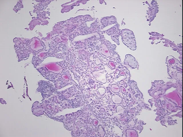 Frozen Tissue Sections, Thyroid gland - image 1