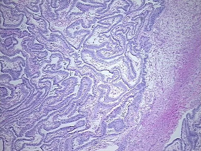 Frozen Tissue Sections, Fallopian tube - image 1