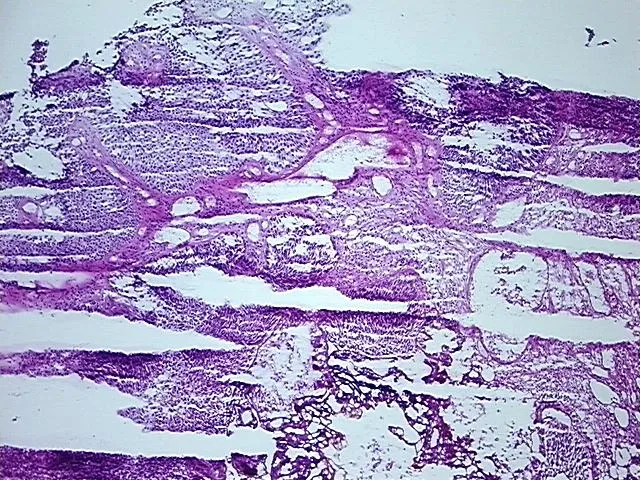 Frozen Tissue Sections, Urinary bladder - image 1