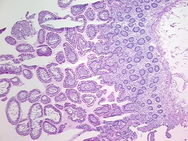 Frozen Tissue Sections, Ileum - image 1