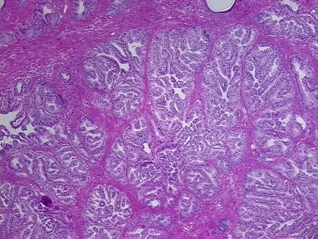 Frozen Tissue Sections, Prostate - image 1