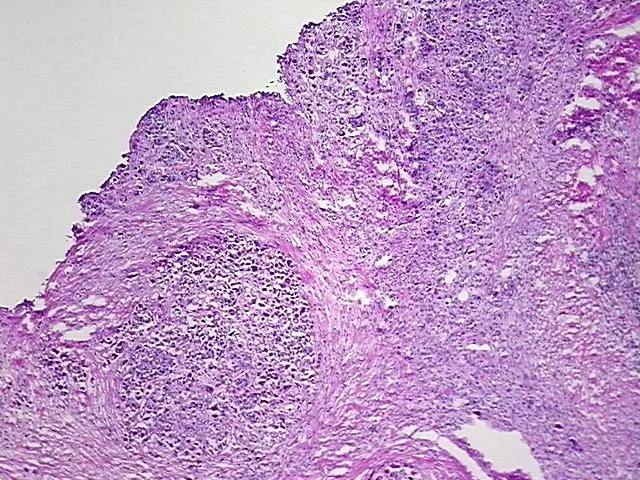 Frozen Tissue Sections, Urinary bladder - image 1