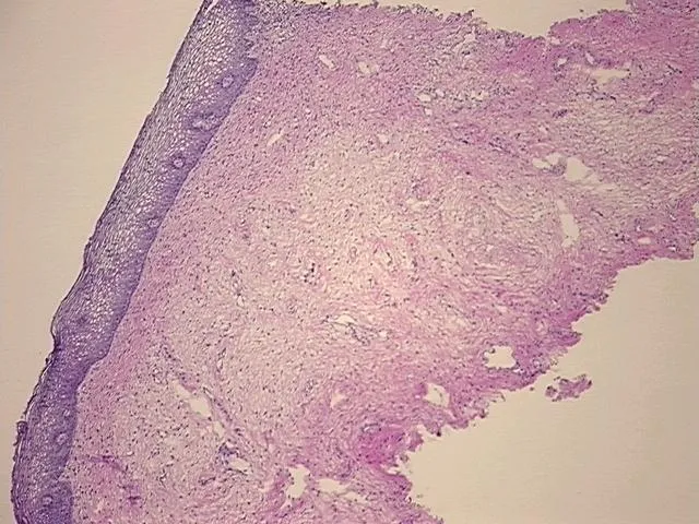 Frozen Tissue Sections, Cervix - image 1