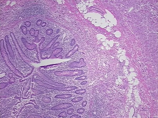 Frozen Tissue Sections, Appendix - image 1