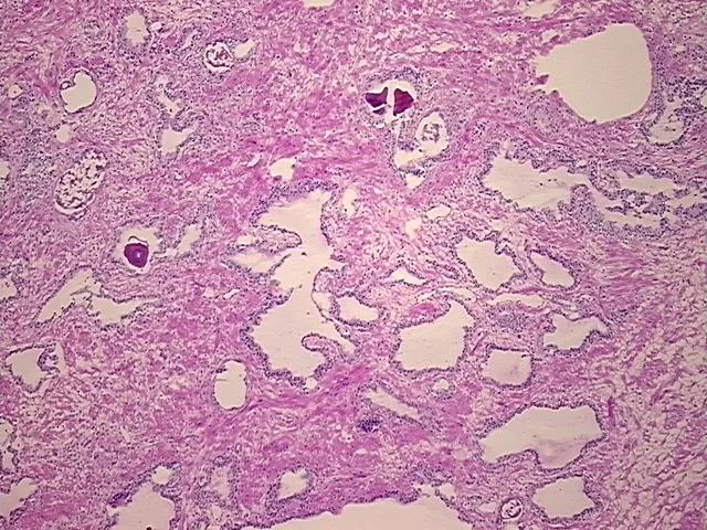 Frozen Tissue Sections, Prostate - image 1