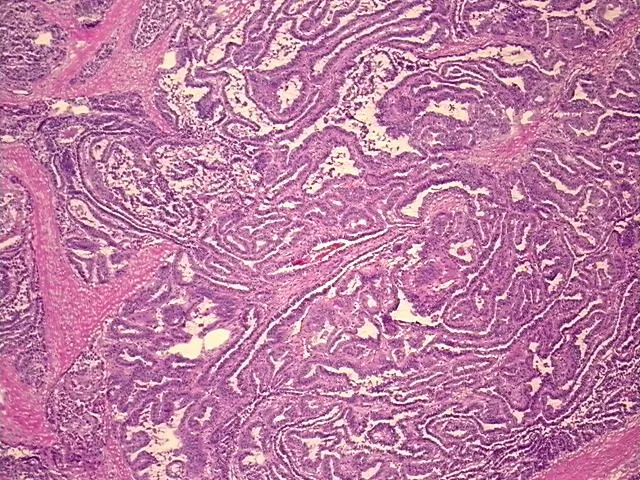 Frozen Tissue Sections, Neck - image 1