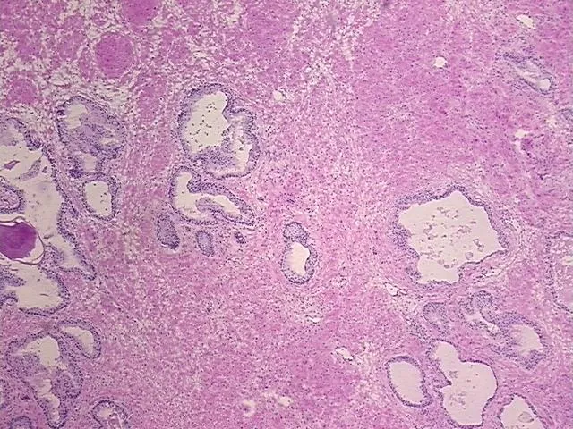 Frozen Tissue Sections, Prostate - image 1
