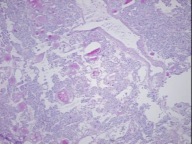 Frozen Tissue Sections, Thyroid gland - image 1