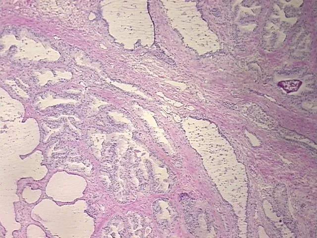 Frozen Tissue Sections, Prostate - image 1