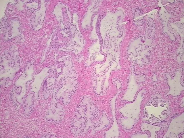 Frozen Tissue Sections, Prostate - image 1
