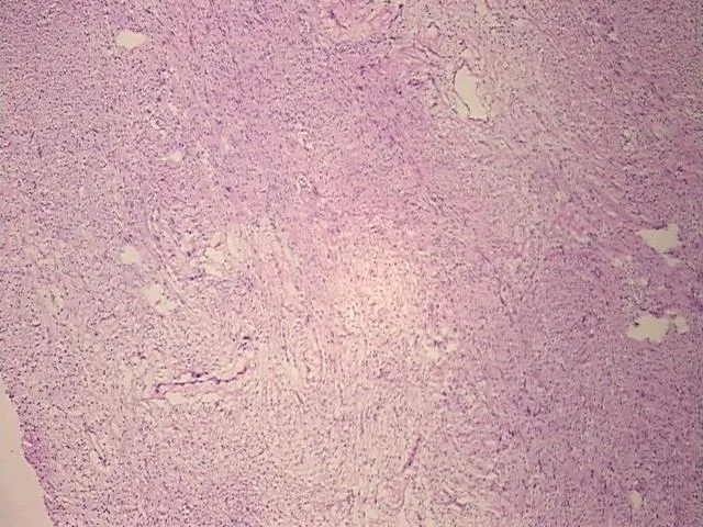 Frozen Tissue Sections, Peripheral nerve - image 1