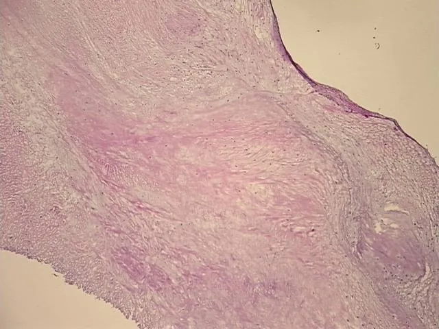 Frozen Tissue Sections, Aortic valve - image 1
