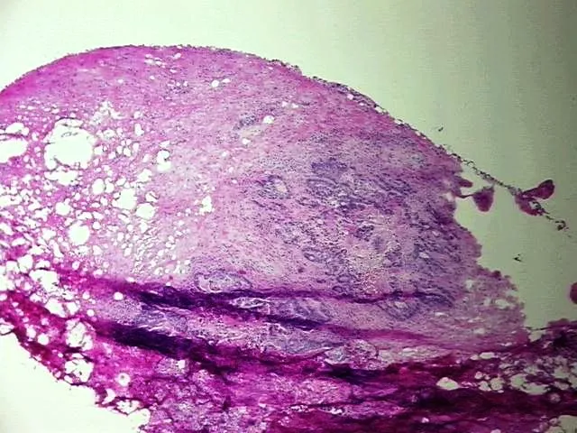 Frozen Tissue Sections, Gallbladder - image 1
