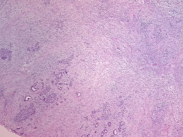 Frozen Tissue Sections, Pancreas - image 1
