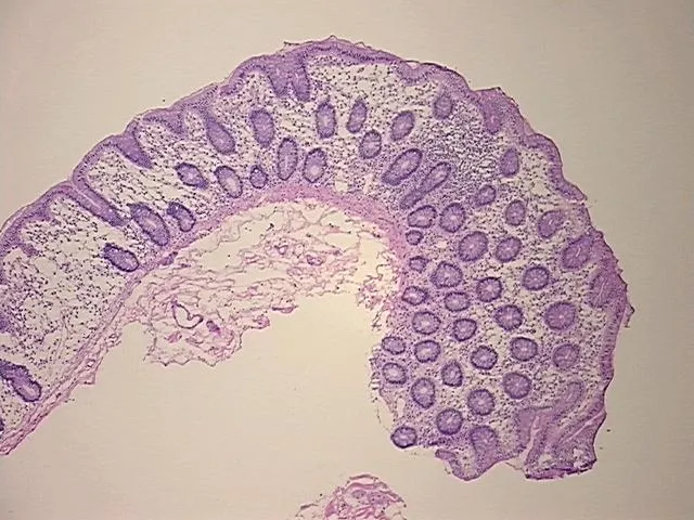 Frozen Tissue Sections, Cecum - image 1
