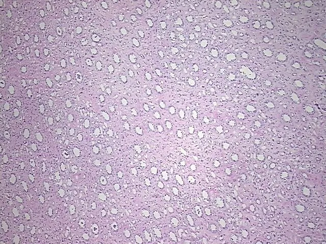 Frozen Tissue Sections, Kidney - image 1