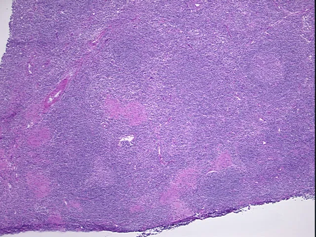 Frozen Tissue Sections, Lymph node - image 1