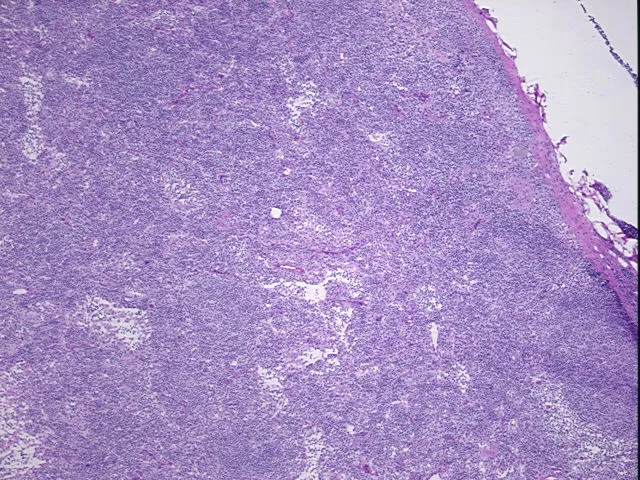 Frozen Tissue Sections, Lymph node - image 1