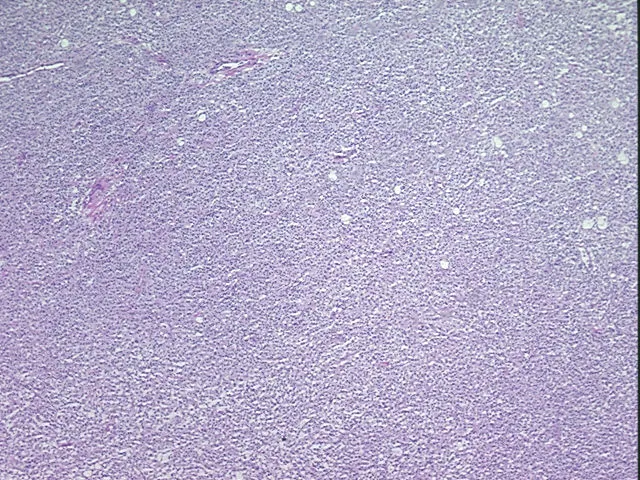 Frozen Tissue Sections, Lymphoid tissue - image 1