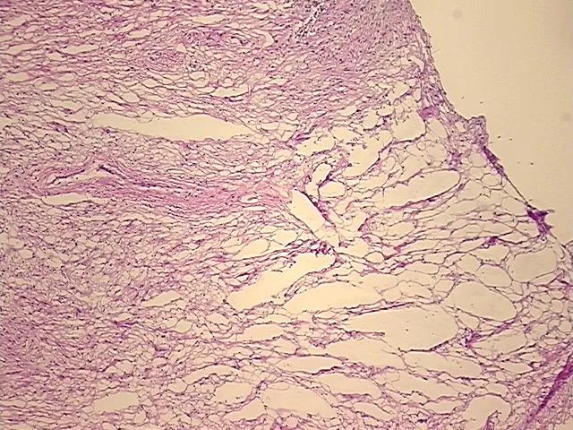 Frozen Tissue Sections, Spinal cord - image 1