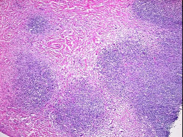 Frozen Tissue Sections, Lymphoid tissue - image 1