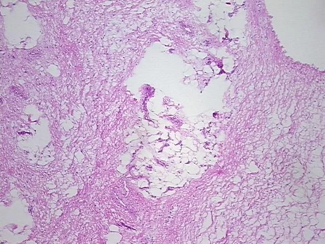 Frozen Tissue Sections, Soft tissue - image 1