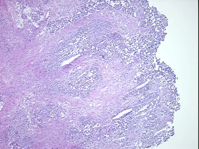 Frozen Tissue Sections, Urinary bladder - image 1