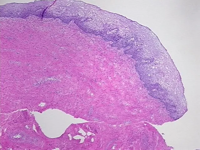 Frozen Tissue Sections, Cervix - image 1