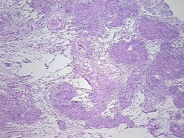 Frozen Tissue Sections, Neural tissue - image 1