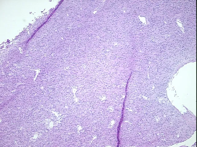 Frozen Tissue Sections, Duodenum - image 1