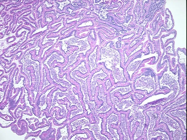 Frozen Tissue Sections, Duodenum - image 1