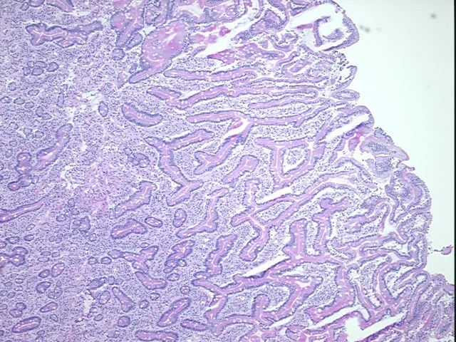 Frozen Tissue Sections, Duodenum - image 1